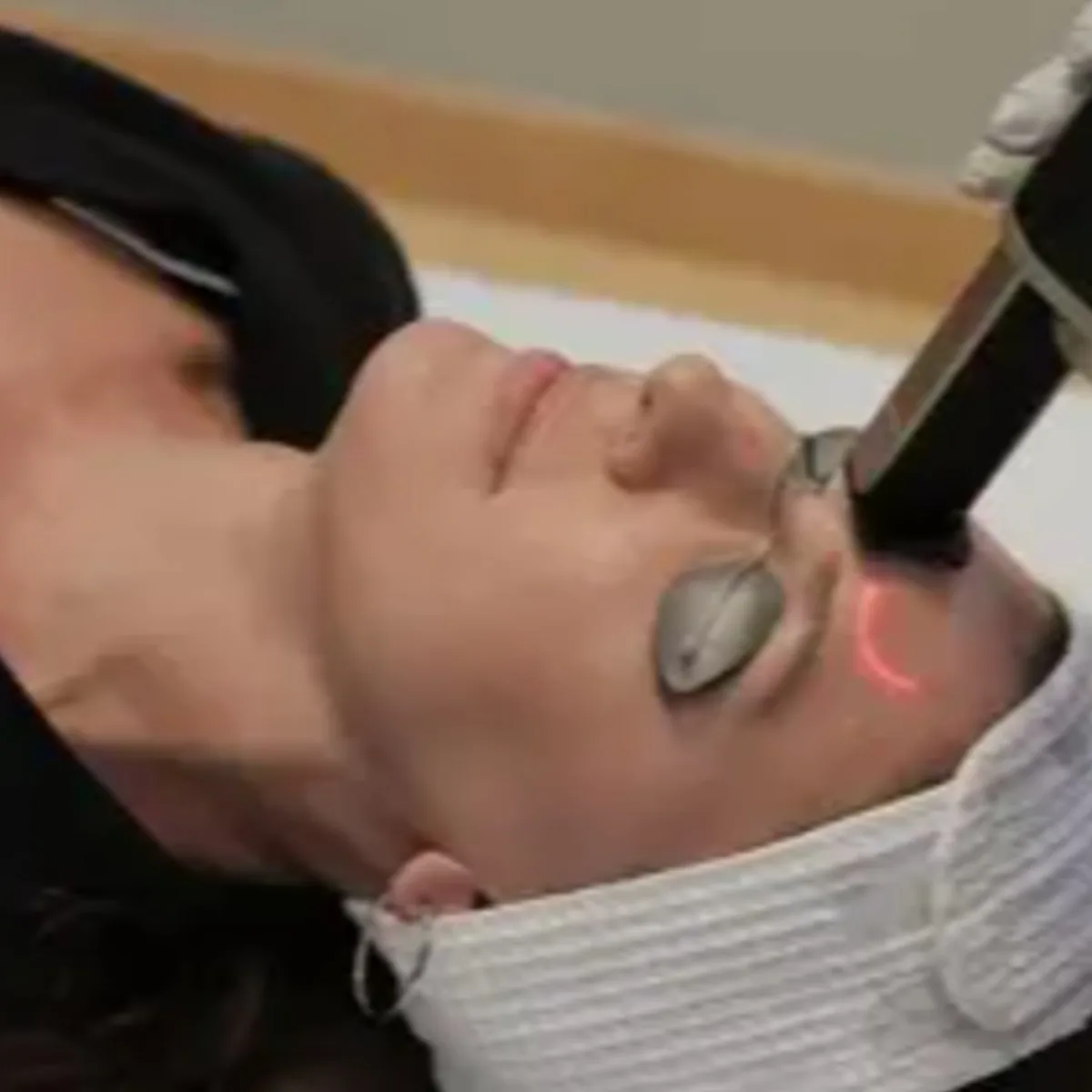 Before HydraFacial Results