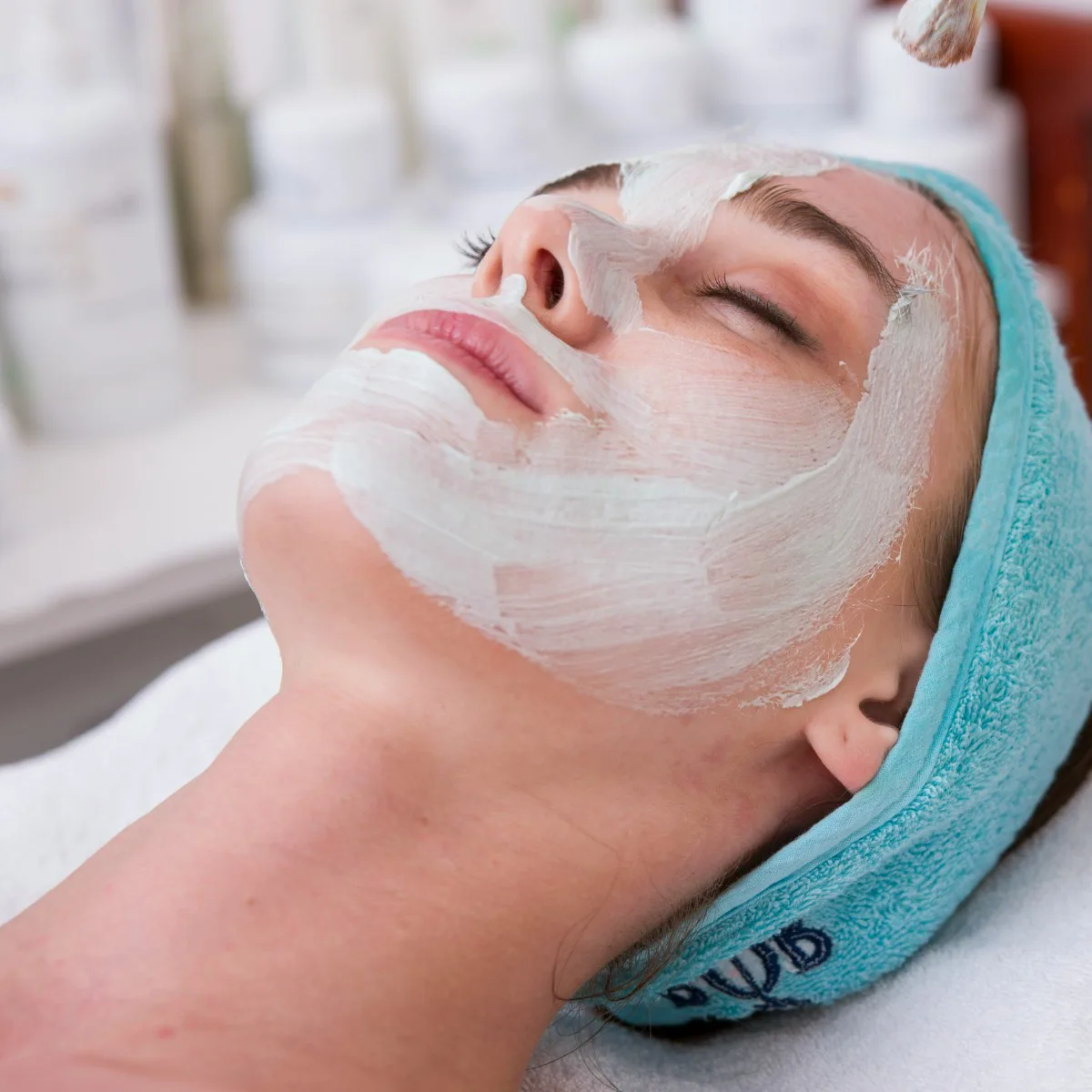 Before IPL Photofacial Results